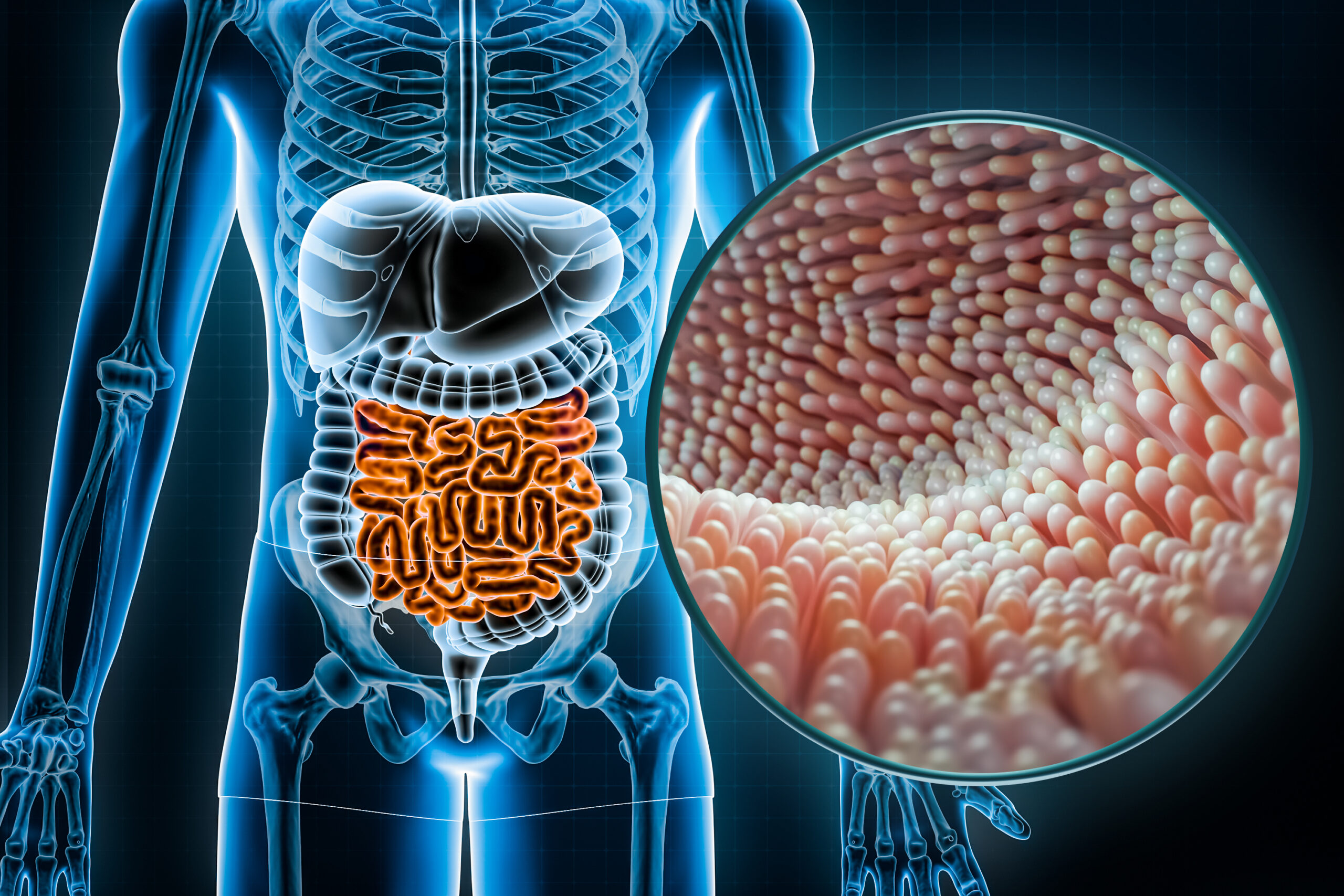 SIBO, microbiome, gut health