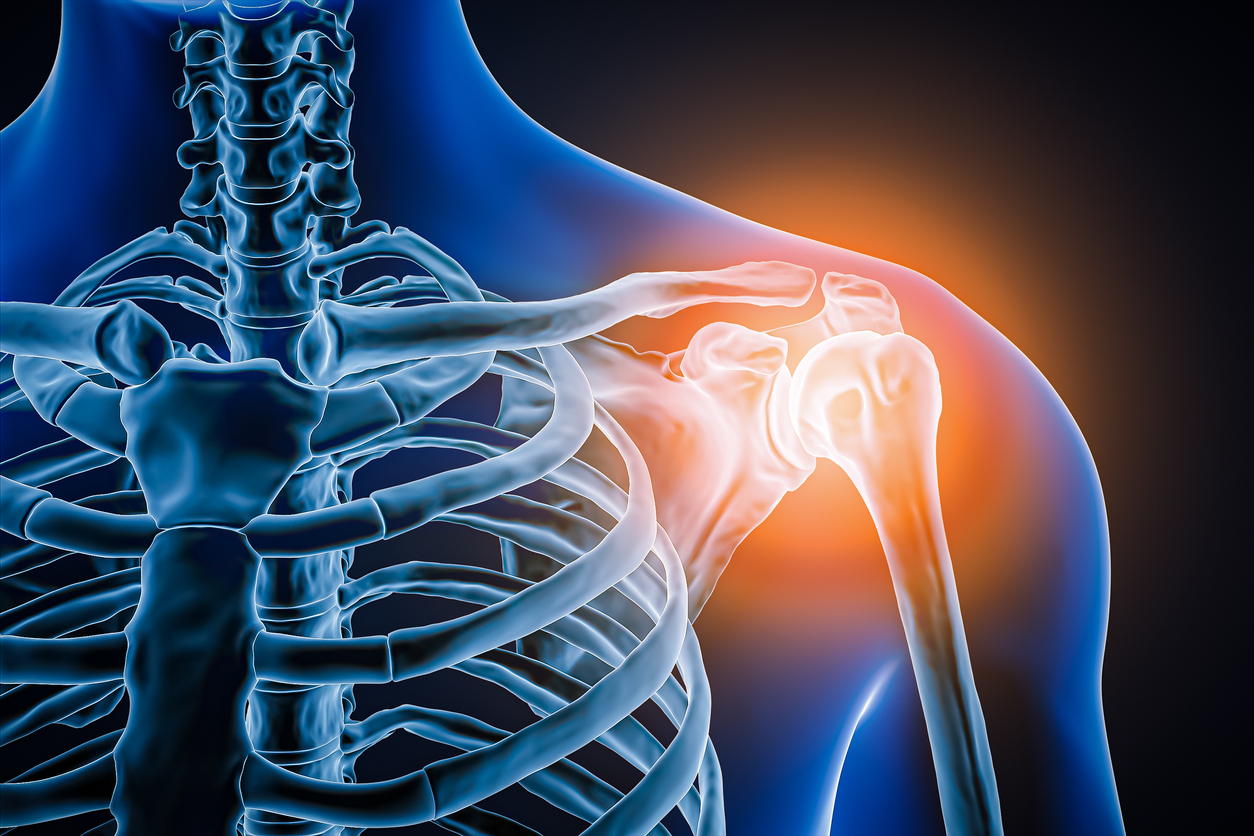 Reducing Inflammation